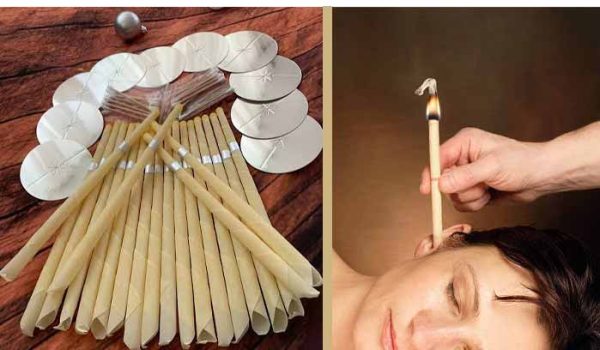 شمع گوش چیست؟ شمع گوش موثر یا کاری خطرناک است؟