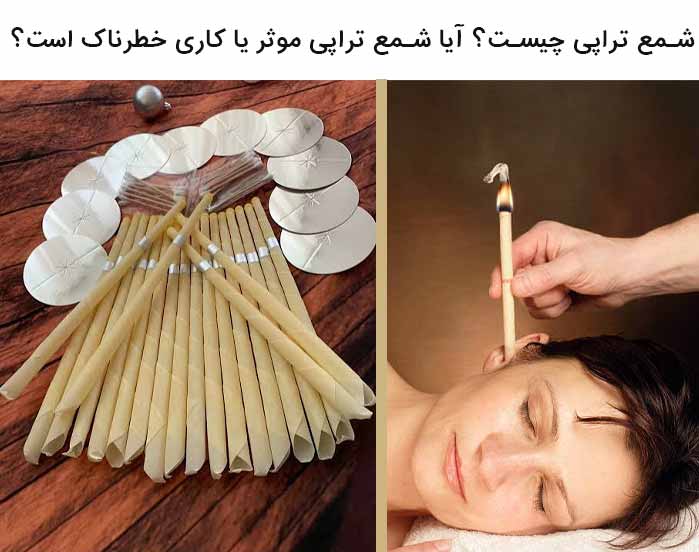 شمع تراپی چیست؟ آیا شمع تراپی موثر یا کاری خطرناک است؟ 1 شمع گوش چیست؟
